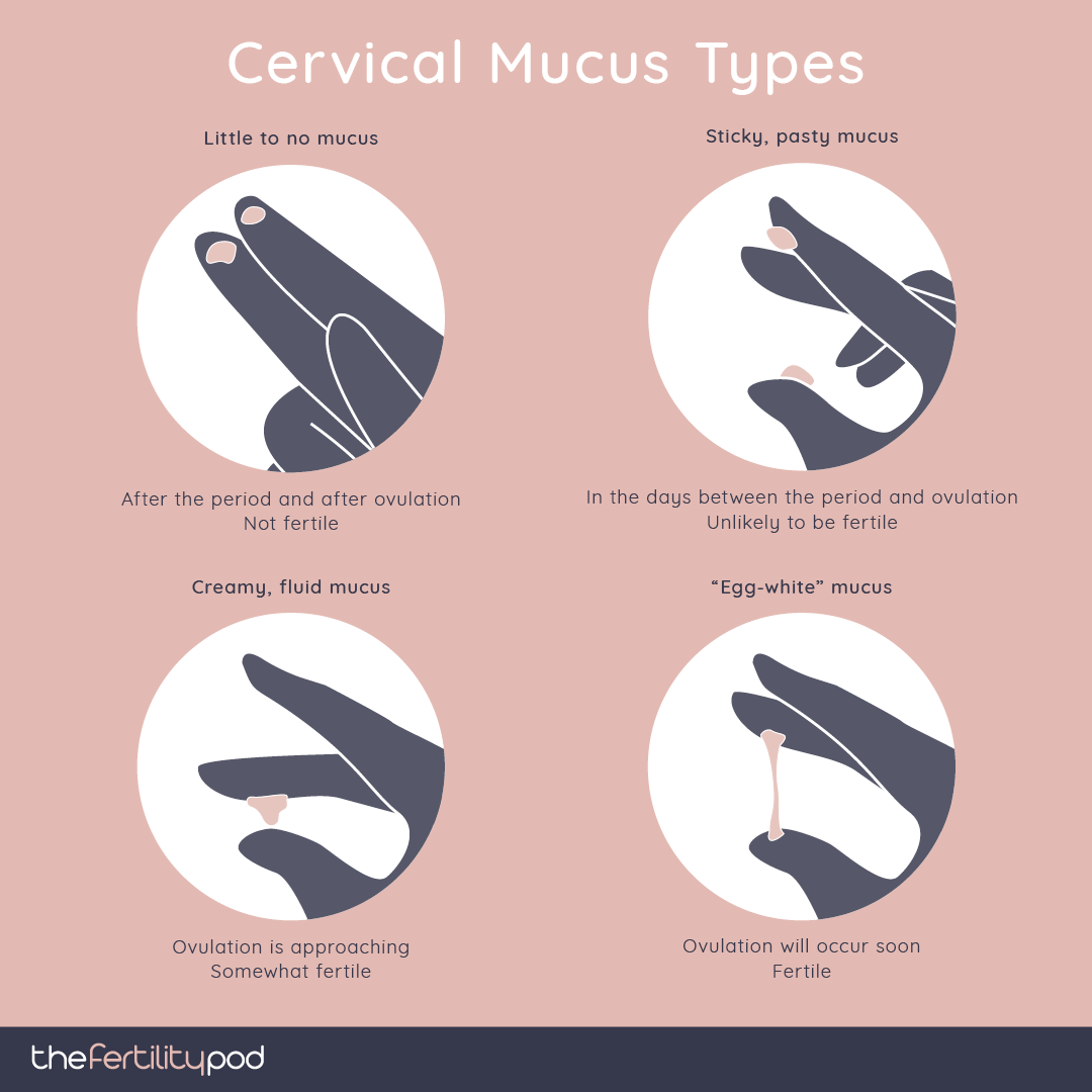 infertile cervical mucus